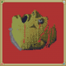 Second Case Trophy
